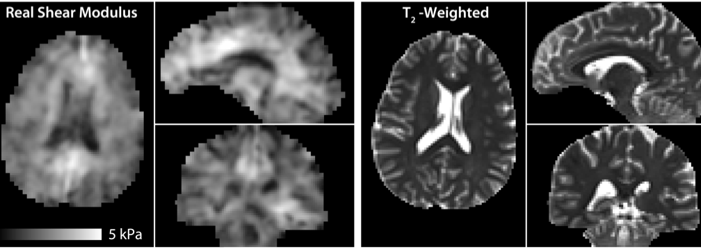 Magnetic Resonance Functional Imaging Lab (MRFIL) | Neuroscience